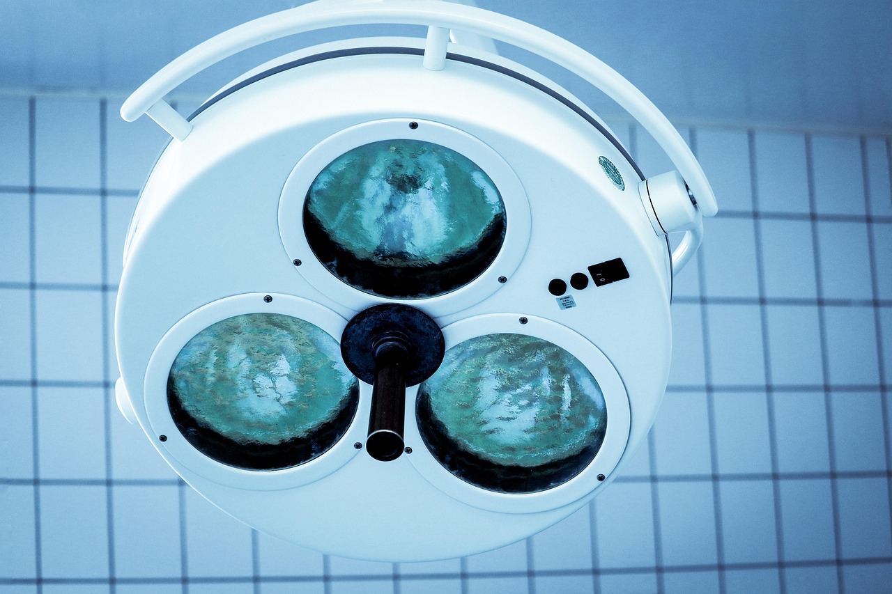 不安全存储漏洞与ddos平台数据如何加密